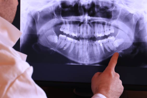 Best Broken or Chipped Tooth Repair in Yaphank, NY
